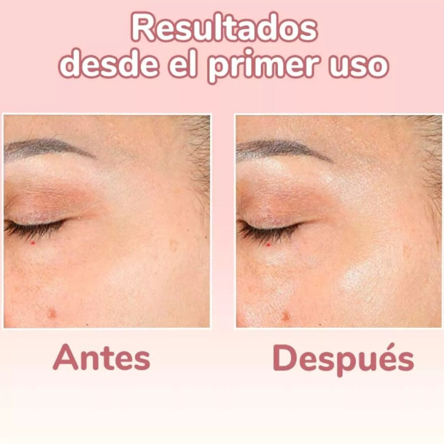 ✨ Título: SkinGlow™ 4 en 1 – Serum Facial con Vitamina C, Ácido Hialurónico, Vitamina E y Niacinamida ✨