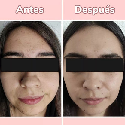 ✨ Título: SkinGlow™ 4 en 1 – Serum Facial con Vitamina C, Ácido Hialurónico, Vitamina E y Niacinamida ✨