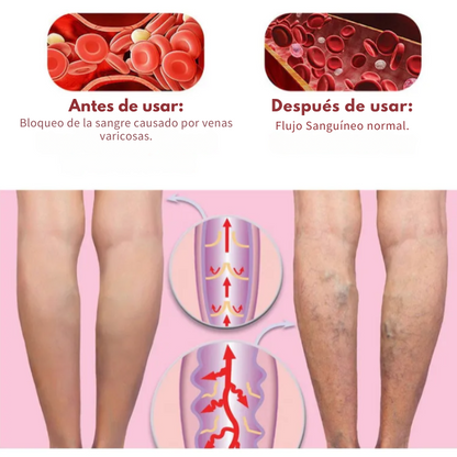 VenoRelief™ 🦵 PIERNAS MÁS LIGERAS, MÁS LIBRES, MÁS BELLAS 🦵
