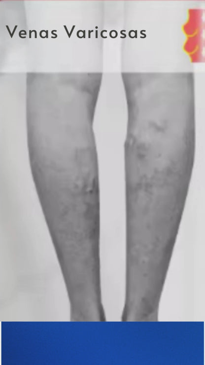 VenoRelief™ 🦵 PIERNAS MÁS LIGERAS, MÁS LIBRES, MÁS BELLAS 🦵